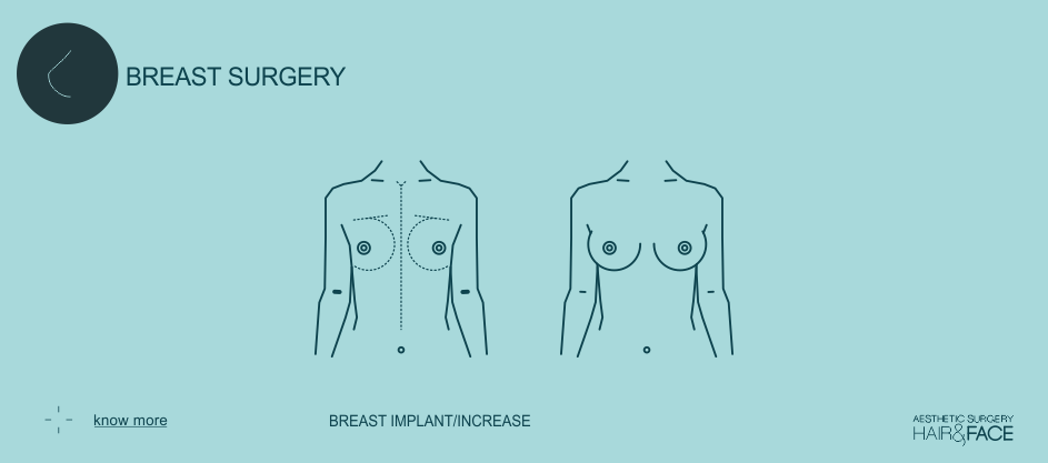 Know more about breast implants / increase